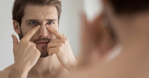 How To Remove Dark Circles?