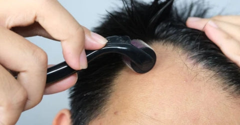 How To Use Derma Roller For Hair Growth?