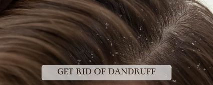 Dandruff Treatment For Men