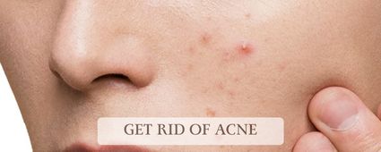 Oily and Acne Prone Skin