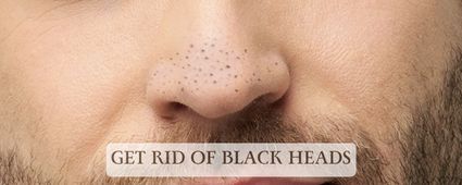 Blackheads Treatment for Men