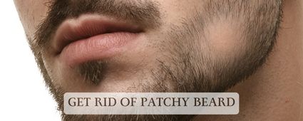 Patchy Beard Treatment For Men