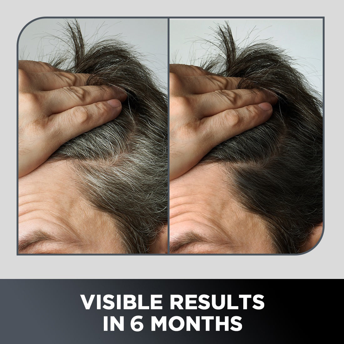 grey-hair-remedy-kit