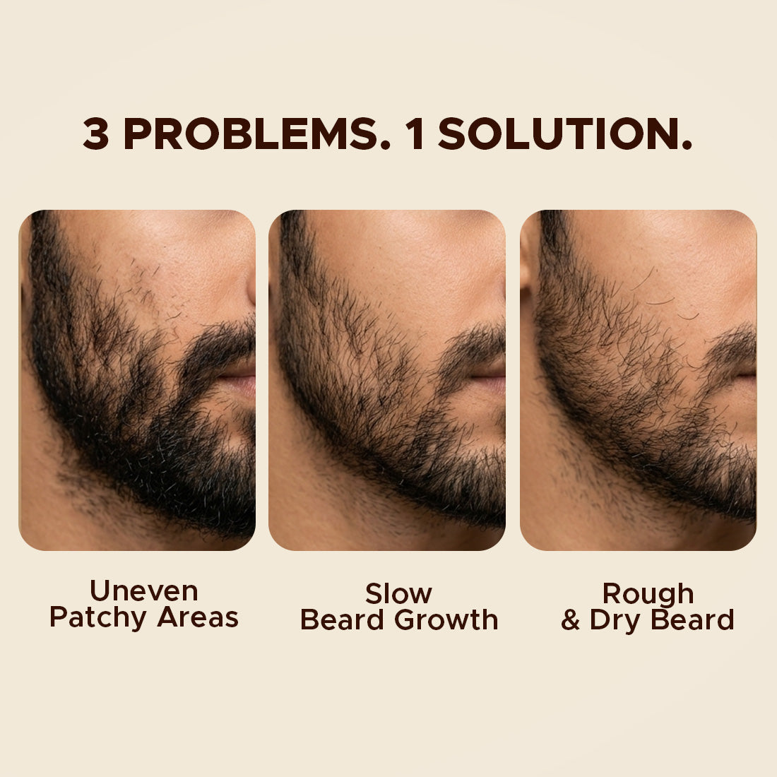 beard-growth-pair