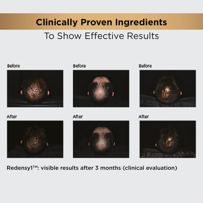 hair-growth-regime-kit