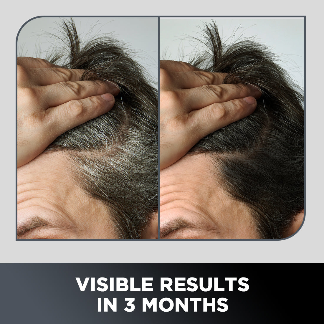 Grey Hair Remedy Kit