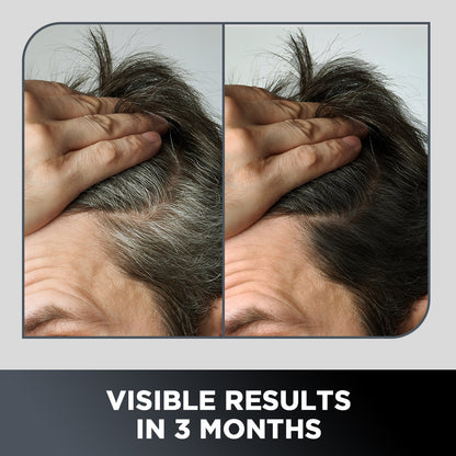 Grey Hair Remedy Kit