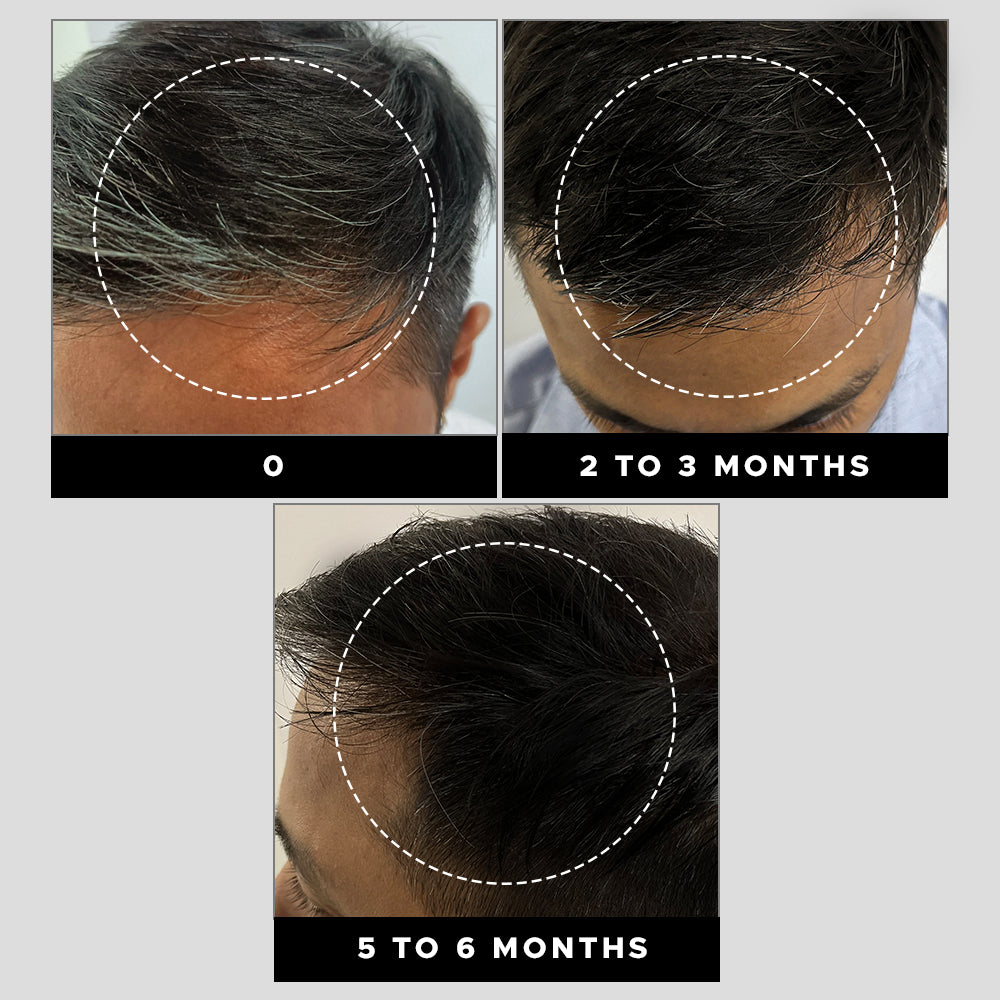 grey-hair-remedy-kit