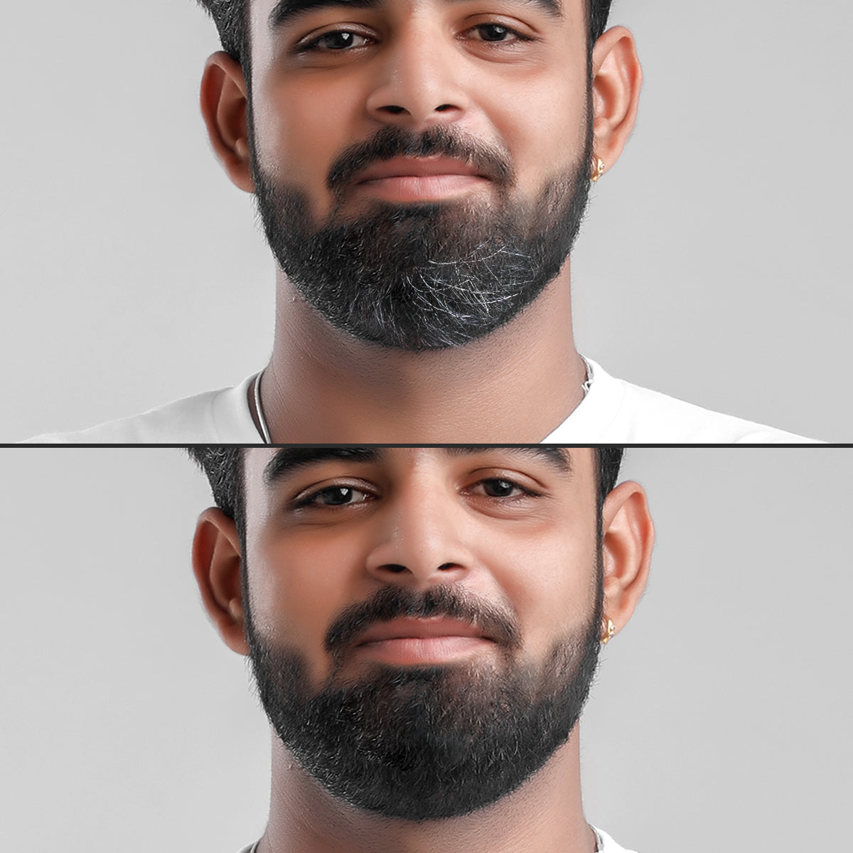 Before-After