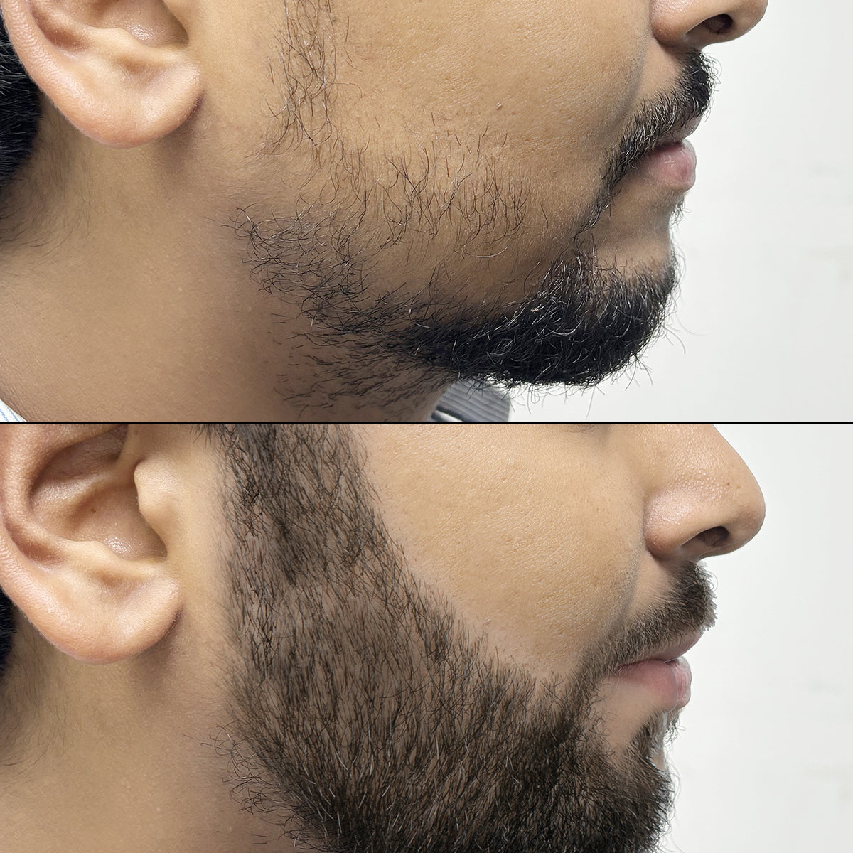 Before-After
