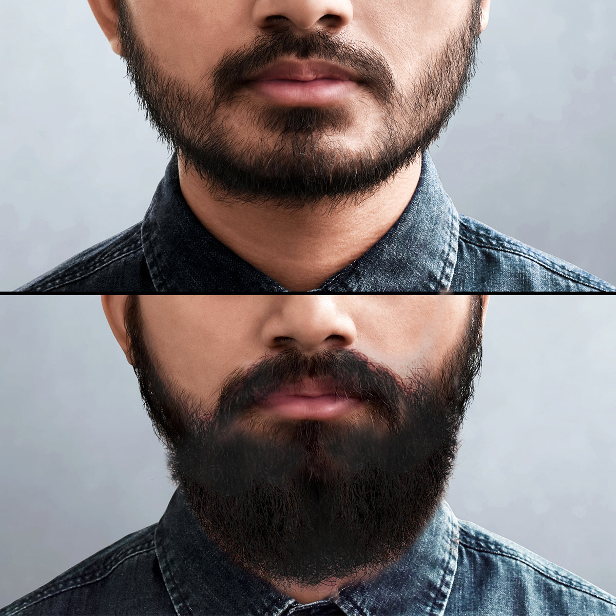 Before-After