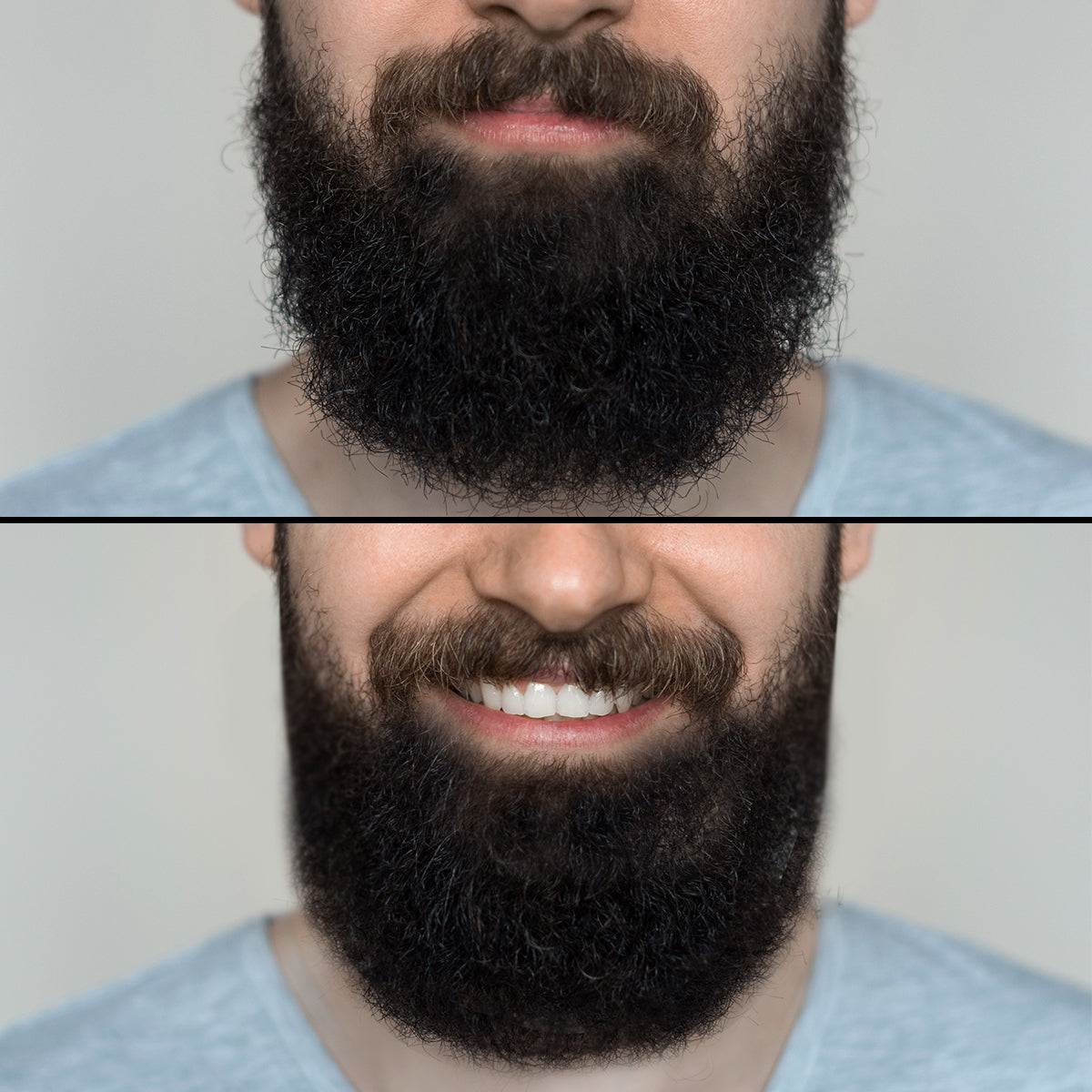 Before-After