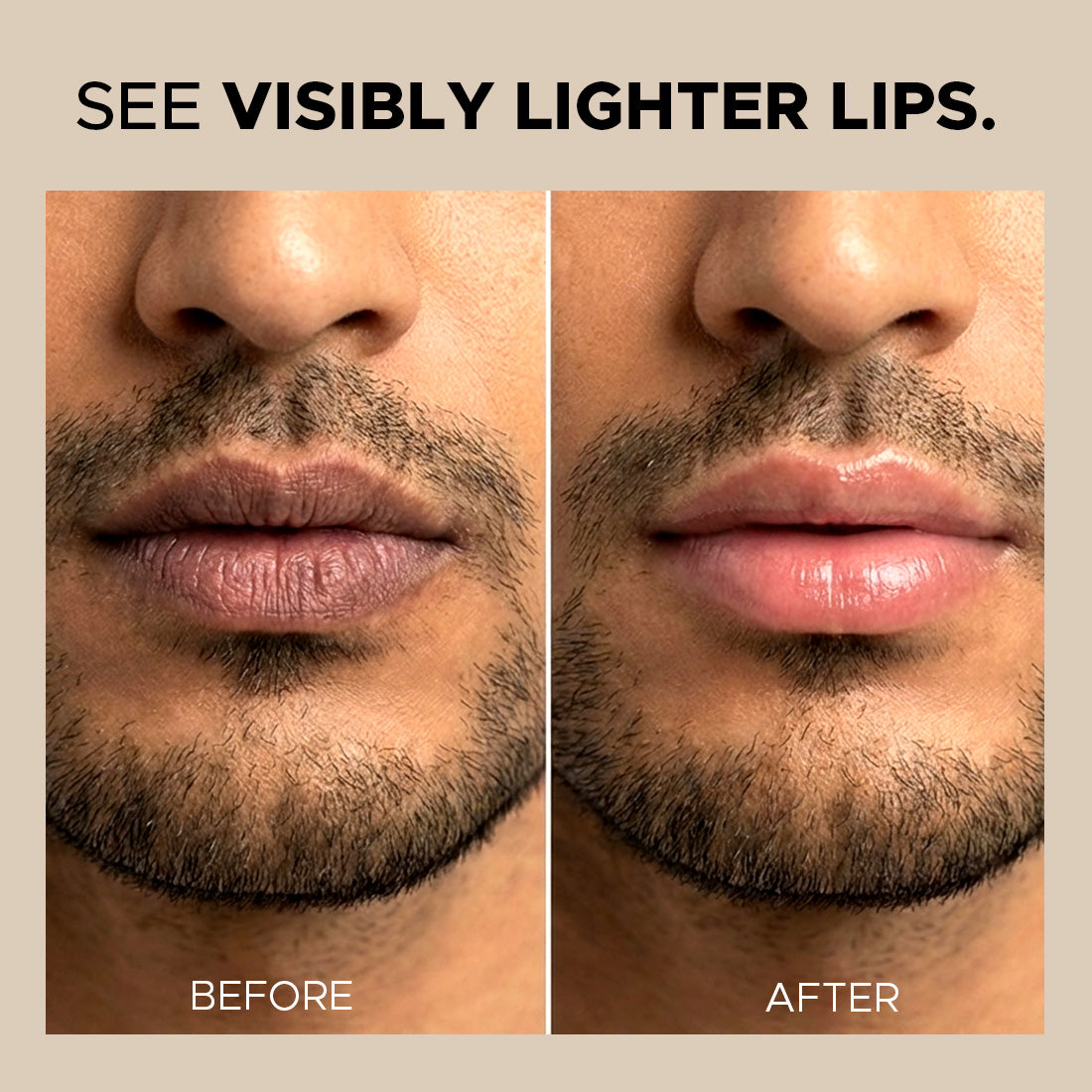 Lip Lightening Regime
