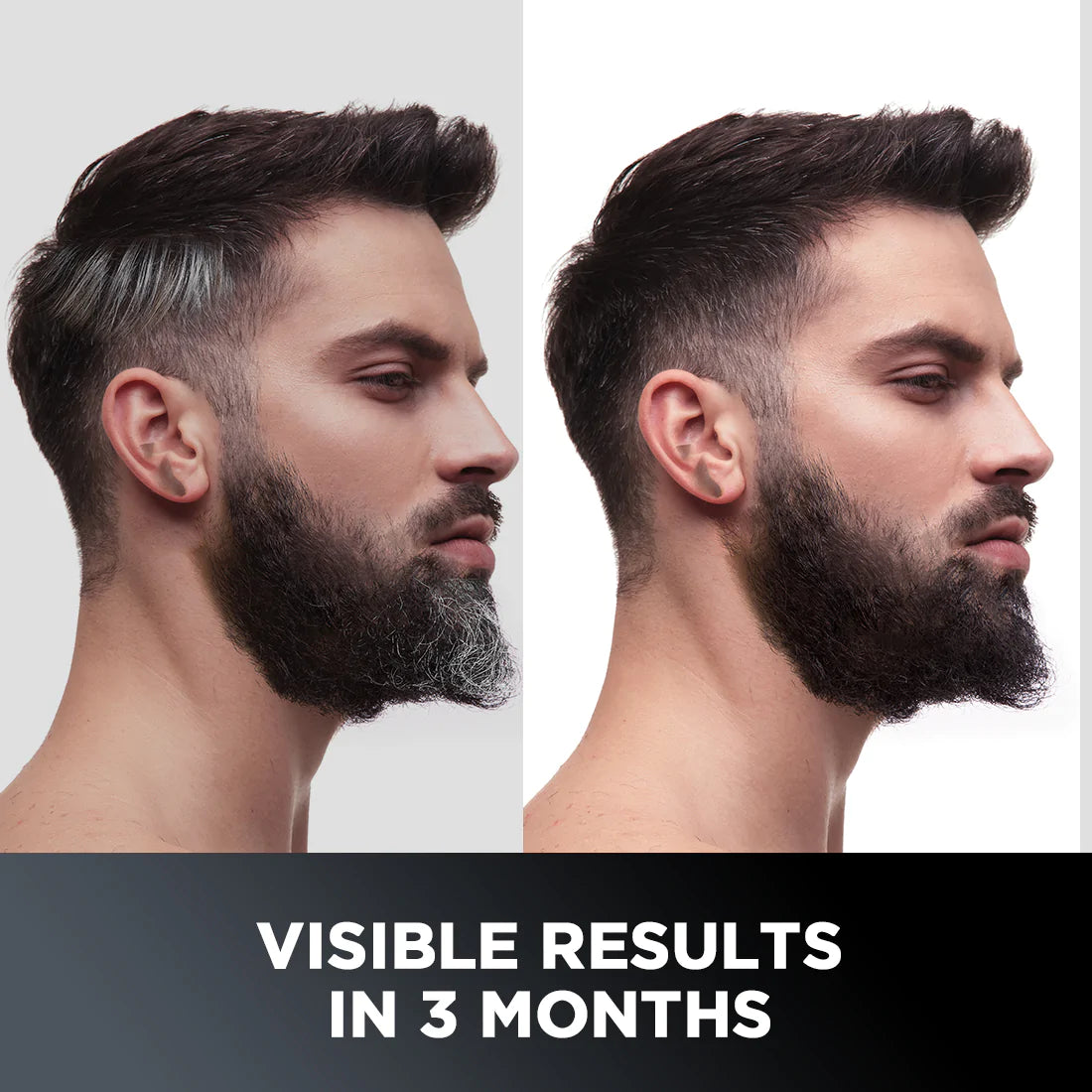 Anti-Graying Hair & Beard Cream | Arcolys & Bhringraj